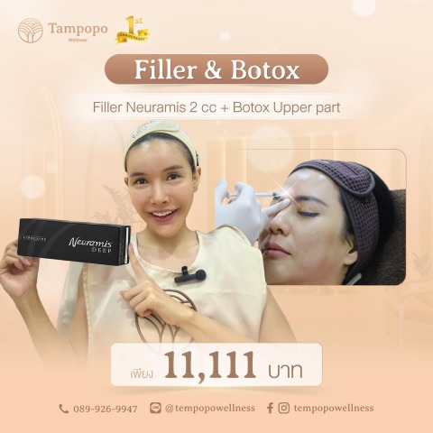 Filler + Botox Upper Part